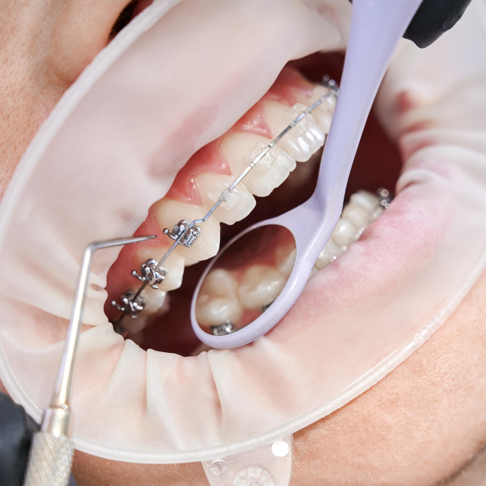 Orthodontist las vegas